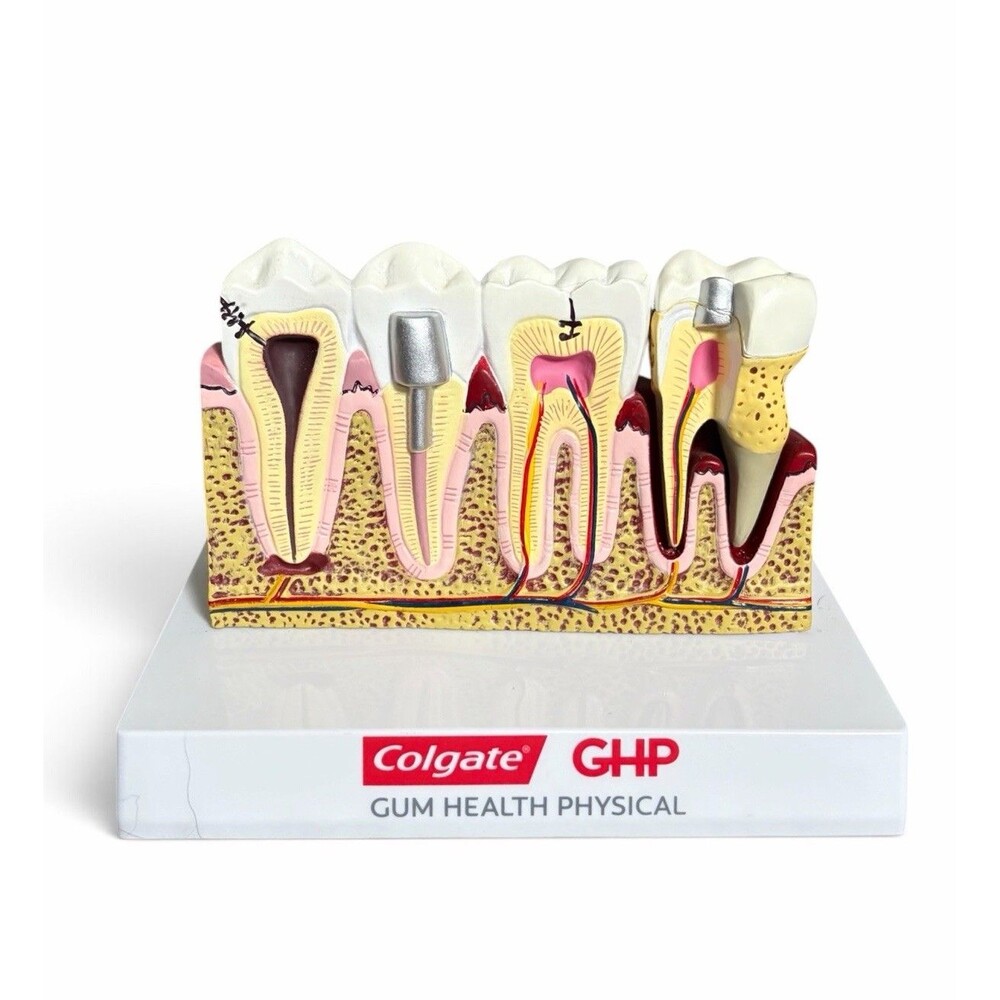 Colgate Large Teeth Anatomy Model with Common Dental Problems Dentist Hygienist